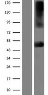 Western Blot: Kir2.2 Overexpression Lysate [NBP2-06575]