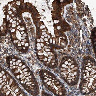 Immunohistochemistry: Kir2.1 Antibody [NBP1-87709]