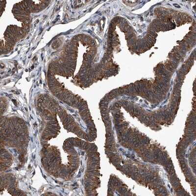 Immunohistochemistry-Paraffin: Kir2.1 Antibody [NBP1-87709]