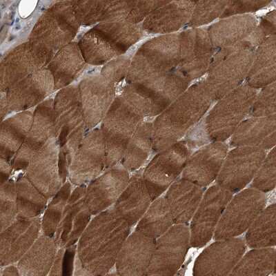 Immunohistochemistry-Paraffin: Kir2.1 Antibody [NBP1-87709]