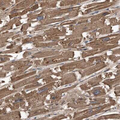 Immunohistochemistry-Paraffin: Kir2.1 Antibody [NBP1-87709]