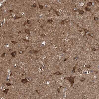 Immunohistochemistry-Paraffin: Kir2.1 Antibody [NBP1-87709]