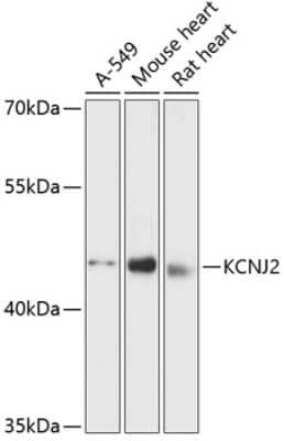 Western Blot: Kir2.1 AntibodyAzide and BSA Free [NBP3-03675]