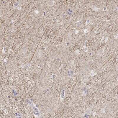 Immunohistochemistry-Paraffin: Kir2.2 Antibody [NBP1-89696]