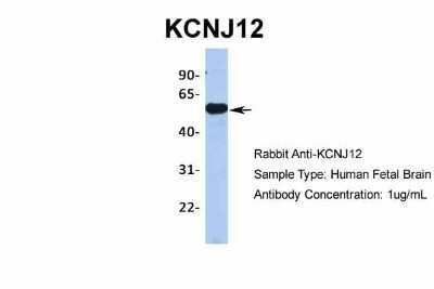 Western Blot: Kir2.2 Antibody [NBP2-87693]