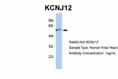 Western Blot: Kir2.2 Antibody [NBP2-87693]