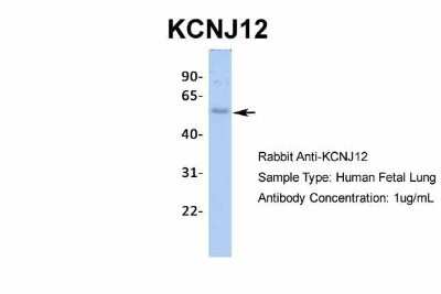 Western Blot: Kir2.2 Antibody [NBP2-87693]