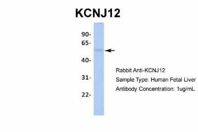 Western Blot: Kir2.2 Antibody [NBP2-87693]