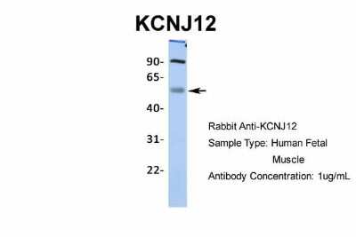 Western Blot: Kir2.2 Antibody [NBP2-87693]
