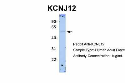 Western Blot: Kir2.2 Antibody [NBP2-87693]