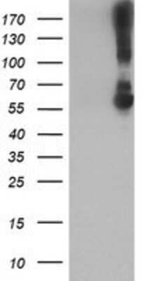 Western Blot: Kir3.1 Antibody (OTI1G3) [NBP2-01702]