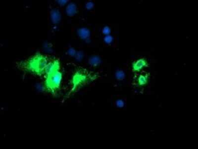 Immunocytochemistry/ Immunofluorescence: Kir3.1 Antibody (OTI1G3) - Azide and BSA Free [NBP2-71065]