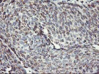 Immunohistochemistry: Kir3.1 Antibody (OTI1G3) - Azide and BSA Free [NBP2-71065]