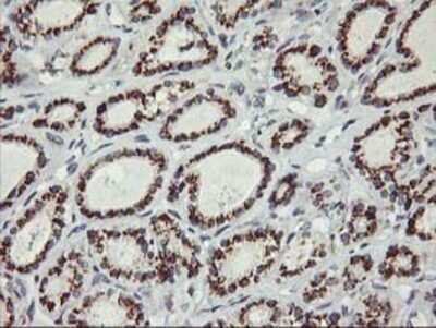 Immunohistochemistry: Kir3.1 Antibody (OTI1G3) - Azide and BSA Free [NBP2-71065]