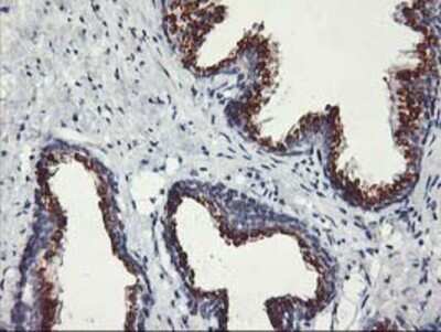 Immunohistochemistry: Kir3.1 Antibody (OTI1G3) - Azide and BSA Free [NBP2-71065]