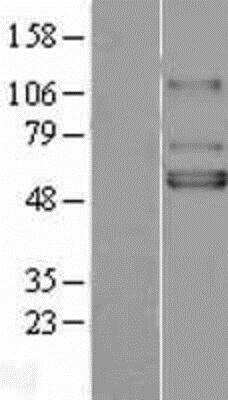 Western Blot: Kir3.1 Overexpression Lysate [NBL1-12170]