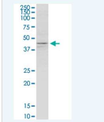 Western Blot: Kir3.4 Antibody (8D2) [H00003762-M01-100ug]