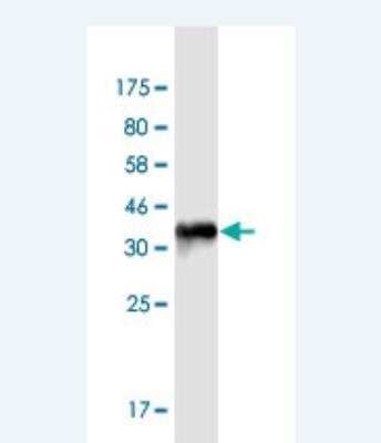 Western Blot: Kir3.4 Antibody (8D2) [H00003762-M01-100ug]