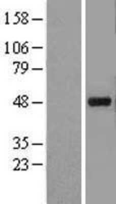 Western Blot: Kir3.4 Overexpression Lysate [NBL1-12172]