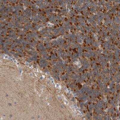 Immunohistochemistry: Kir3.1 Antibody [NBP1-89770]