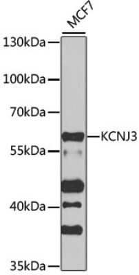 Western Blot: Kir3.1 AntibodyBSA Free [NBP3-03002]