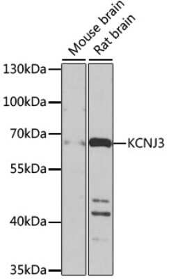 Western Blot: Kir3.1 AntibodyBSA Free [NBP3-03003]