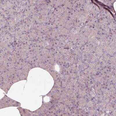 Immunohistochemistry-Paraffin: Kir3.3 Antibody [NBP2-57515]