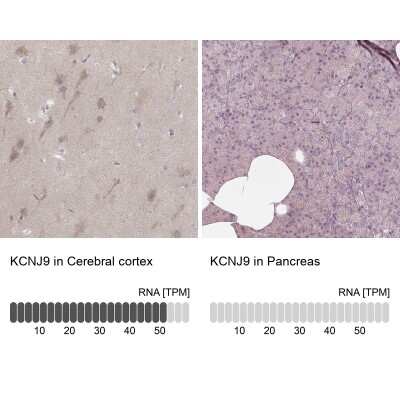 Immunohistochemistry-Paraffin: Kir3.3 Antibody [NBP2-57515]