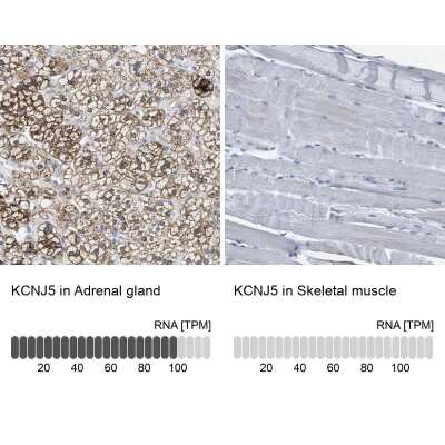 Immunohistochemistry-Paraffin: Kir3.4 Antibody [NBP1-88081]