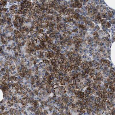 Immunohistochemistry-Paraffin: Kir3.4 Antibody [NBP1-88081]