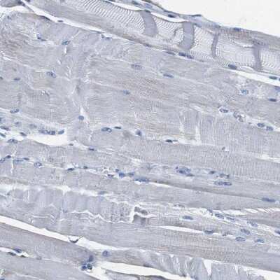 Immunohistochemistry-Paraffin: Kir3.4 Antibody [NBP1-88081]