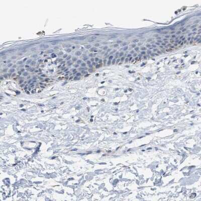 Immunohistochemistry-Paraffin: Kir3.4 Antibody [NBP1-88081]