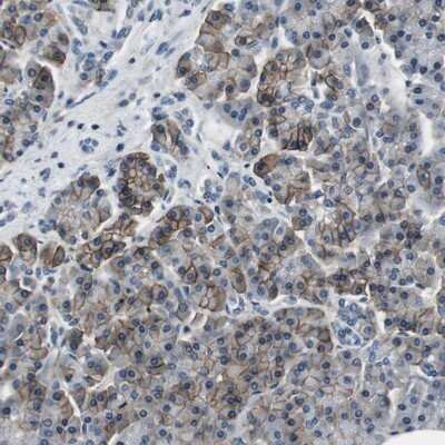 Immunohistochemistry-Paraffin: Kir3.4 Antibody [NBP1-88082]