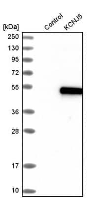 Western Blot: Kir3.4 Antibody [NBP1-88081]