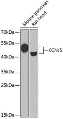 Western Blot: Kir3.4 AntibodyBSA Free [NBP3-03006]