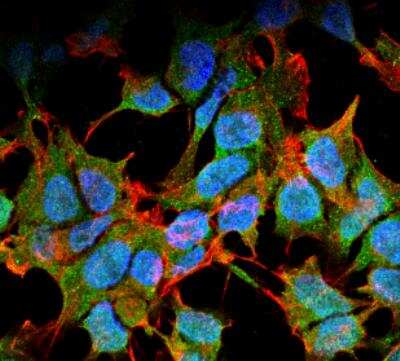 Immunocytochemistry/ Immunofluorescence: Kir6.1 Antibody (S366-60) [NBP2-59324]