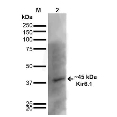 Western Blot: Kir6.1 Antibody (S366-60) [NBP2-59324]