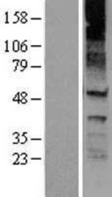 Western Blot: Kir6.1 Overexpression Lysate [NBL1-12174]