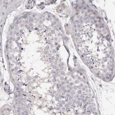 Immunohistochemistry-Paraffin: Kir6.1 Antibody [NBP1-87710]