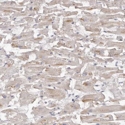 Immunohistochemistry-Paraffin: Kir6.1 Antibody [NBP1-87710]