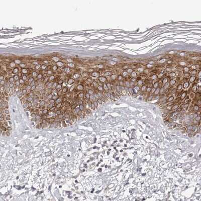 Immunohistochemistry-Paraffin: Kir6.1 Antibody [NBP1-87710]