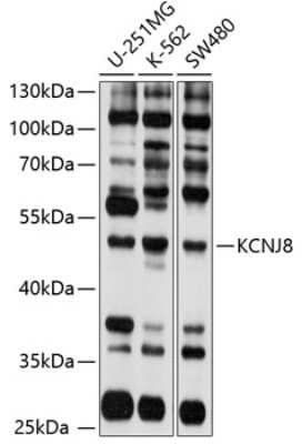 Western Blot: Kir6.1 AntibodyBSA Free [NBP3-03677]