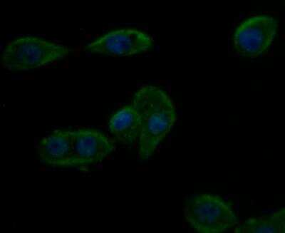 Immunocytochemistry/ Immunofluorescence: Kir6.2 Antibody [NBP2-76944]