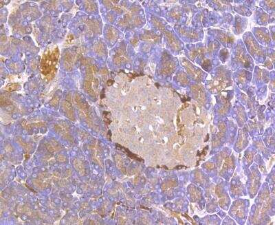 Immunohistochemistry: Kir6.2 Antibody [NBP2-76944]
