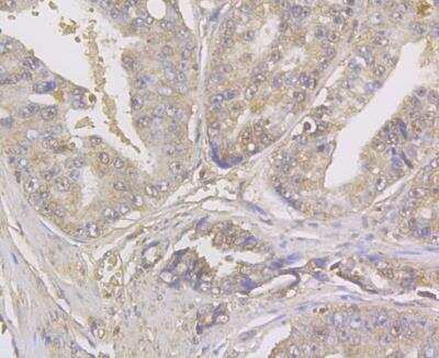 Immunohistochemistry: Kir6.2 Antibody [NBP2-76944]