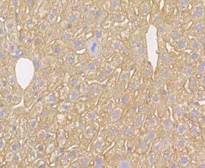 Immunohistochemistry: Kir6.2 Antibody [NBP2-76944]