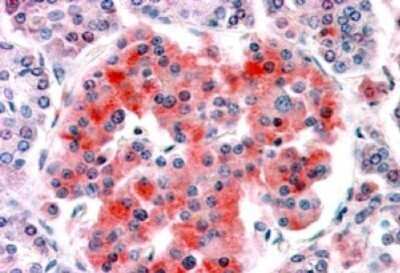 Immunohistochemistry-Paraffin: Kir6.2 Antibody [NB100-93410]