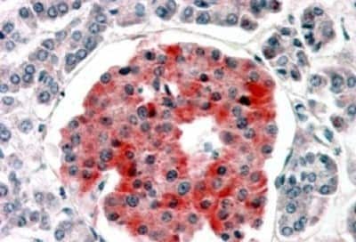 Immunohistochemistry-Paraffin: Kir6.2 Antibody [NBP1-00206]