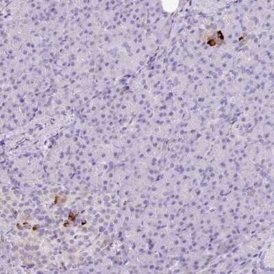 Immunohistochemistry-Paraffin: Kir6.2 Antibody [NBP2-33540]