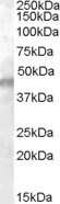 Western Blot: Kir6.2 Antibody [NB100-93410]